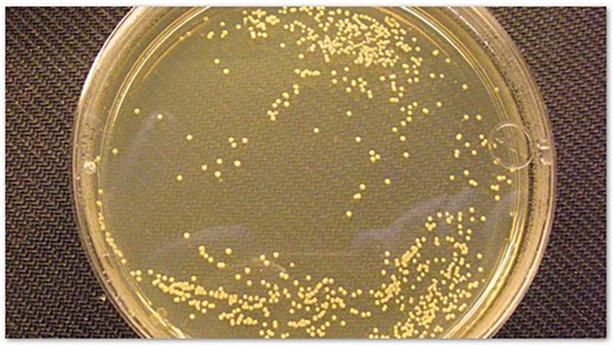 Grand Challenges Explorations Phase II Grants Awarded