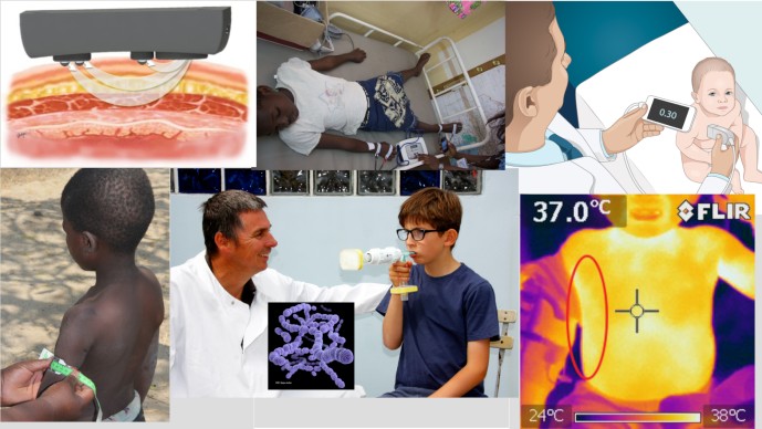 New Ways of Quickly Diagnosing Children Most at Risk for Pneumonia
