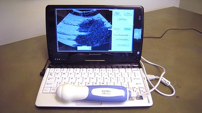 Create New Technologies to Improve the Health of Mothers and Newborns (Round 6)
