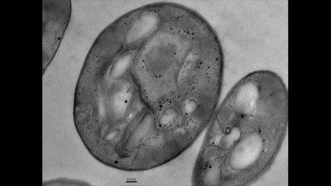 Exploring New Solutions: Micronutrient Fortification for Mothers and Infants