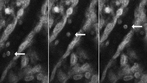 Needle-Free Microscopy for Malaria Diagnosis