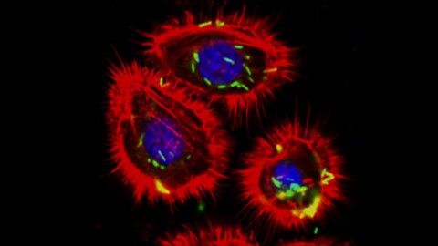 Mucosal Immunity: Using a Common Oral Bacteria to Deliver Vaccines Under the Tongue