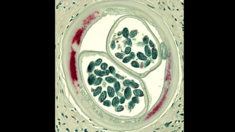 Protecting Against Infectious Disease: Targeting Bacterial Genes To Treat Neglected Tropical Diseases