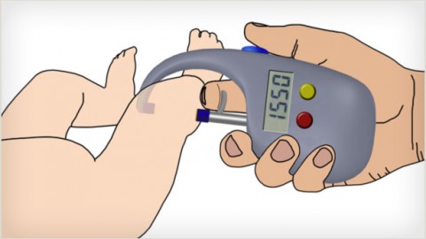 Maternal and Infant Health: Developing a Hand-held Device to Diagnose Newborn Dehydration